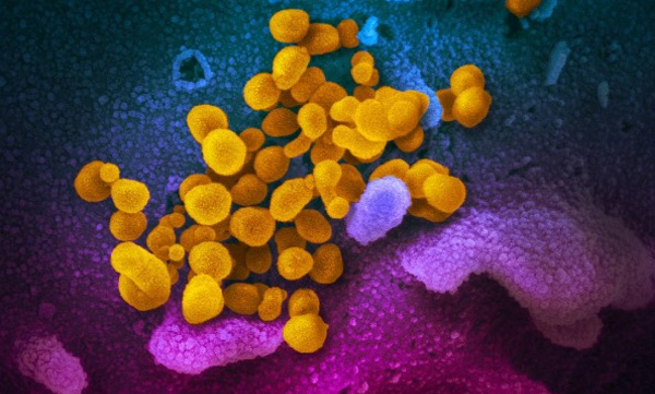 The origin of the covid virus is from the Chinese lab itself: the US media released the report