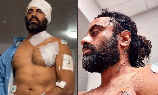 Jodhaa Akbar actor attacked in California gym