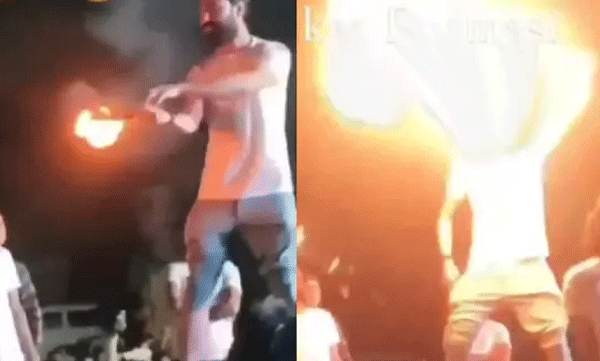 Youth’s face catches fire while performing stunt