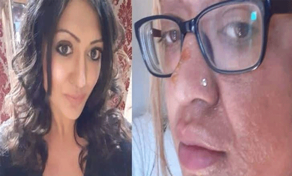 cooking following tiktok hack egg exploded in face