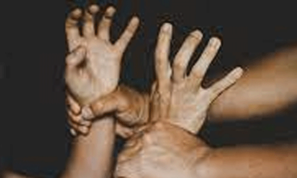 assault against malayalee youth in manglore