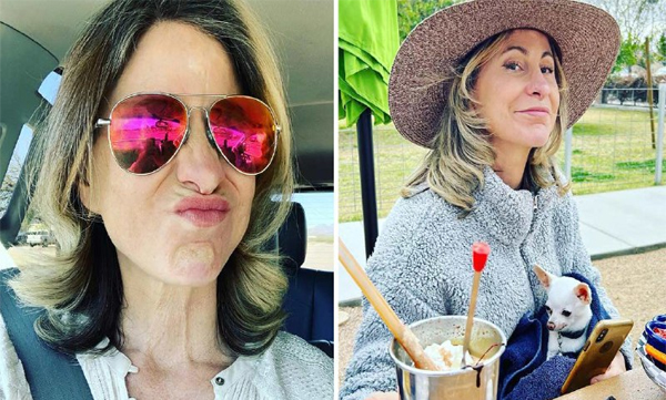 If you look at your face, you should look 30 years old: 50-year-old woman sold her house for cosmetic surgery