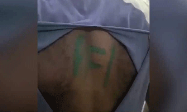 army-jawan-attacked-and-painted-pfi-on-his-back-in-kollam-police-registered-case