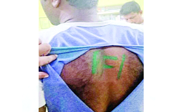 attack against army man