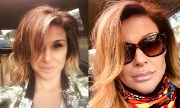 Actress Jacqueline Carrieri, who underwent plastic surgery to enhance her beauty, met with a tragic end