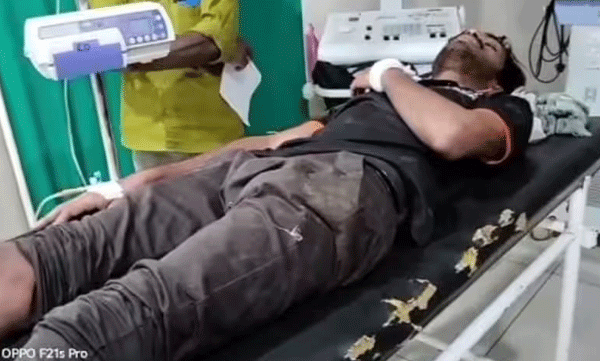 wild buffalo attacked a scooter passenger leaving him badly injured
