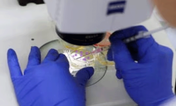 health department has started an investigation on asha worker suffered severe burns during the biopsy test in alappuzha

