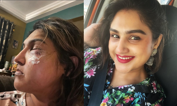 vanitha-vijayakumar-revealed-she-brutally-attacked-by-unidentifiable-person-