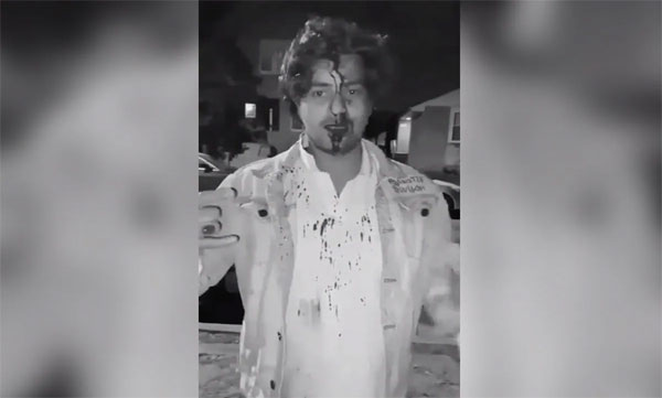 Indian Student Chased, Attacked By Four Men In Chicago