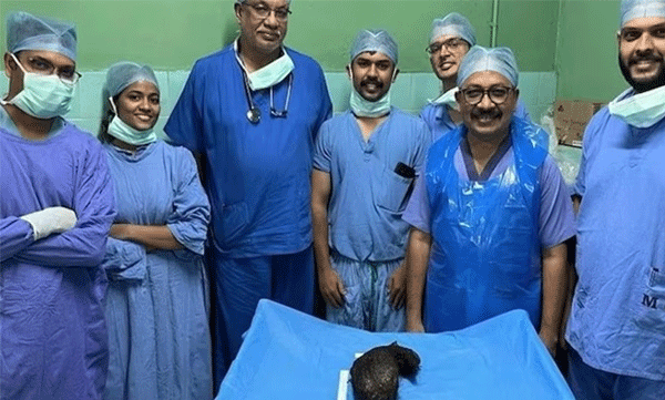 hair-bundle-weighing-two-kilos-removed-from-the-stomach-of-a-10th-class-girl-btb