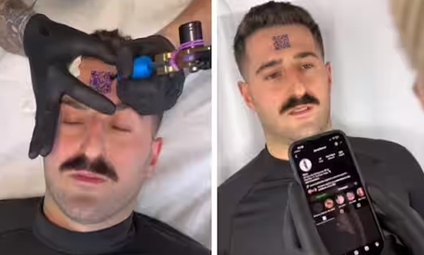 youth-trolled-on-social-media-for-putting-qr-code-on-his-forehead