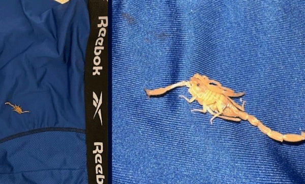 man-bitten-by-scorpion-in-private-parts-sues-las-vegas-hotel