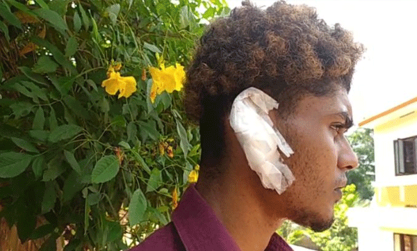 Young man was attacked and his ear bitten off