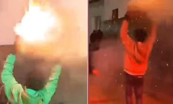 man-dancing-with-firecrackers-over-head-then-this-is-happened
