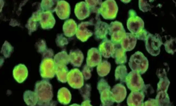 children-under-observation-negative-for-amoebic-meningoencephalitis-test