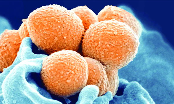 The world of science is worried that the world will be gripped by another pandemic after Covid