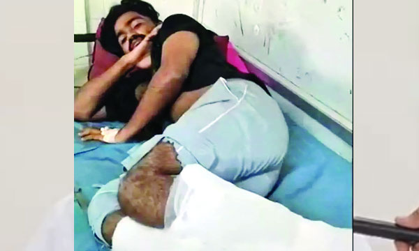 Afraid of CITU people; A young man fell from a building and was seriously injured