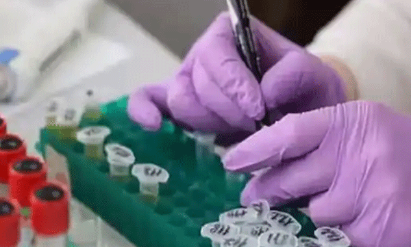 Chandipura virus outbreak; 22 children have been diagnosed with the virus and 117 are under treatment