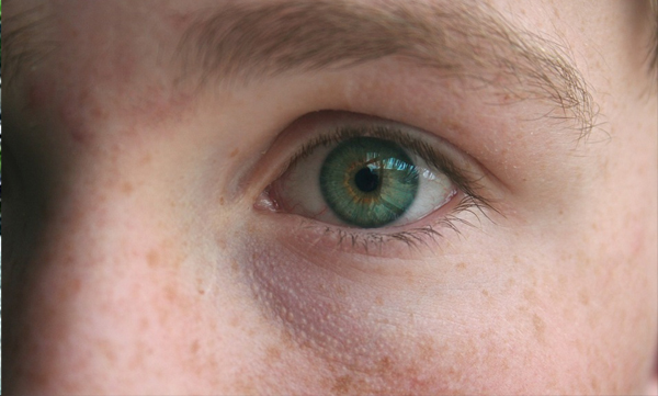 chinese-man-lost-his-left-eye-after-he-was-beaten-to-death-by-an-insect-in-his-face