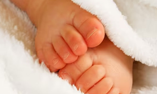 An unusual deformity of a newborn in Alappuzha