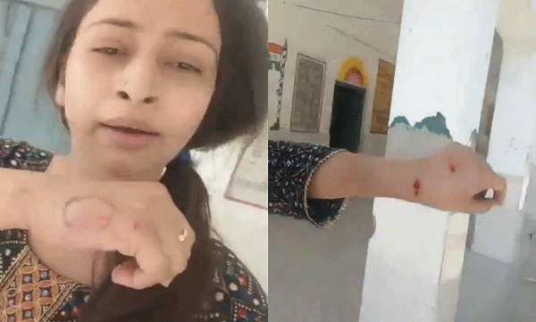 principal-s-facial-massage-in-kitchen-during-class-teacher-who-took-video-bitten-and-injured-video-goes-viral