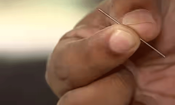 piece-of-needle-found-at-infant-s-leg-case-against-doctor-and-nurse-in-pariyaram-medical-college-