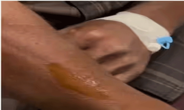 leopard-attack-reported-in-wayanad-man-hospitalised-with-minor-injuries