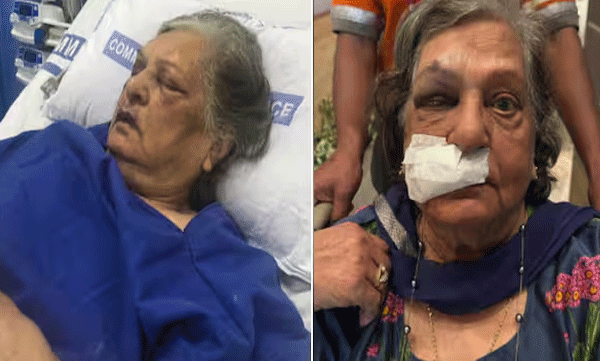 woman-files-serious-complaint-against-air-india-elderly-woman-falls-and-gets-injured-after-not-providing-wheelchair