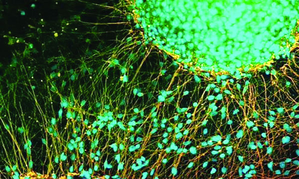 Researchers in Japan develop stem cell treatment