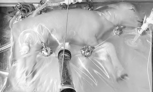 Bodyoids to revolutionize medicine