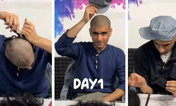 young-man-shaves-his-head-to-count-his-hair-strands-social-media-says-unemployment-is-true