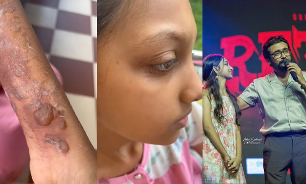 Anjali Nair about aavani's mishap during retro shooting