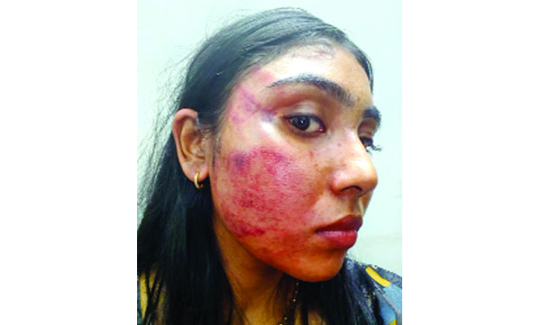 The complaint of the junior lawyer was brutally beaten by the senior