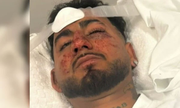 Indian man brutally beaten in Australia; Racially insulted, beaten and knocked unconscious