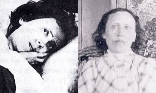 The Girl Who Slept For 32 Years