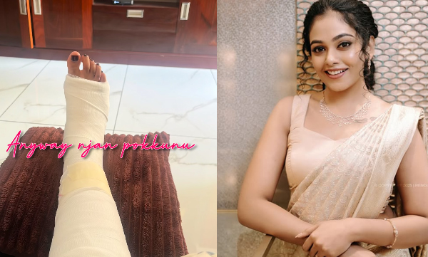 actress-rebecca-santhosh-ankle-injury-video