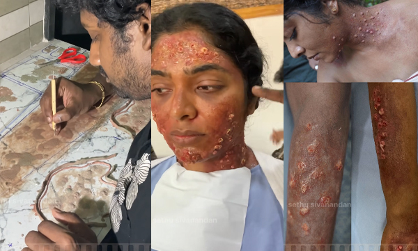 Makeup artist Sethu Sivanandan shares the Rima Kallingal's prosthetic makeup 