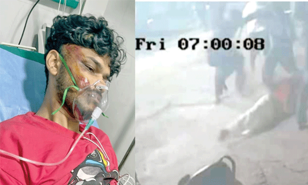 nri-youth-attacked-by-mob-in-malappuram-interfere-in-dispute-with-brother