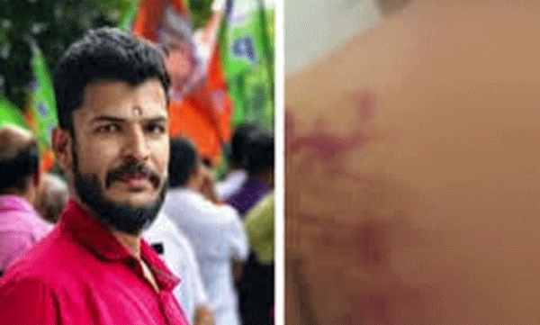 yuvamorcha-leader-custody-for-cruelly-beaten-partner-kochi