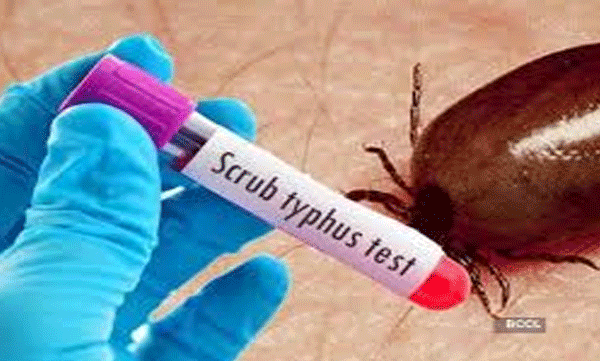 scrub-typhus-spread-in-andhra-pradesh-8-died-so-far