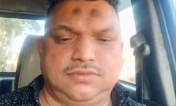 Suicide attempt of the family by setting the car on fire; The young man died and the three children were rescued