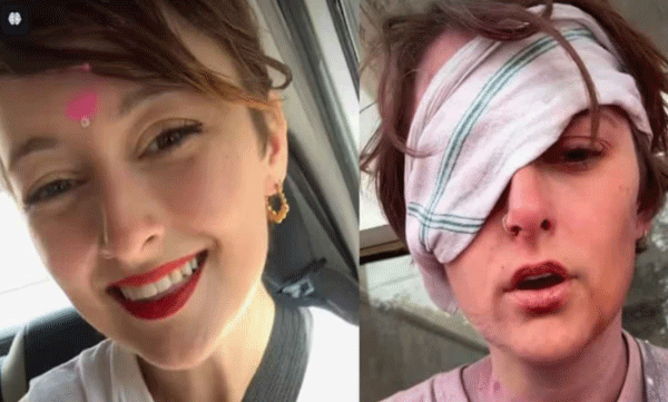 viral-video-austrian-tourist-claims-injured-eye-by-throwing-stones-mixed-holi-colors