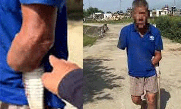 viral-video-of-old-man-who-lost-both-arms-hospitalized-with-cobra-that-bite-him