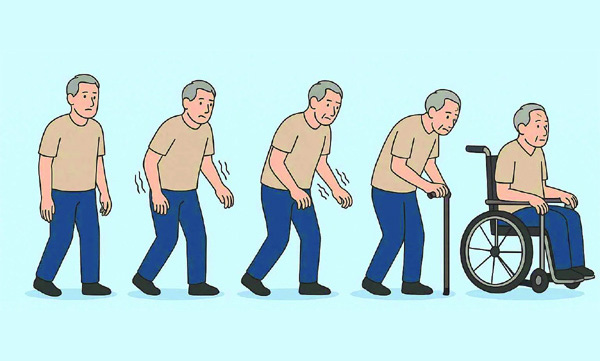 Parkinson's is not just about tremors