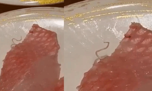 live-parasite-found-sushi-hong-kong-restaurant