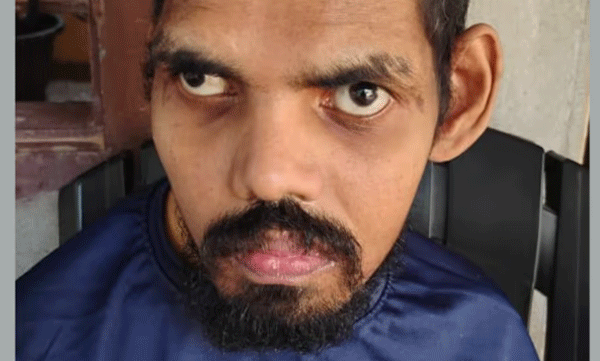 മഞ്ചേരി മെഡിക്കൽ കോളേജിൽ ചികിത്സയിലിരി​ക്കെ മരിച്ചയാൾക്ക് ഷിഗെല്ല സ്ഥിരീകരിച്ചു